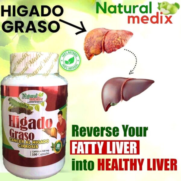 Hígado Graso Natural Medix